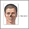 Septoplasty - series - Septal anatomy Septoplasty - series - Septal anatomy