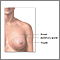 Normal female breast anatomy Normal female breast anatomy