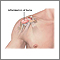 Bursitis of the shoulder Bursitis of the shoulder