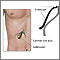 Gallbladder endoscopy Gallbladder endoscopy