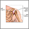 Shoulder joint inflammation Shoulder joint inflammation