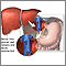Donor liver attachment Donor liver attachment