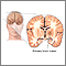 Primary brain tumor Primary brain tumor