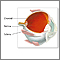 Choroid of the eye Choroid of the eye