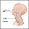 Endotracheal intubation Endotracheal intubation