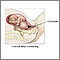 Internal fetal monitoring Internal fetal monitoring