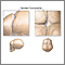 Sunken fontanelles (superior view) Sunken fontanelles (superior view)