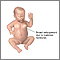 Hormonal effects in newborns Hormonal effects in newborns