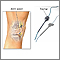 Synovial biopsy Synovial biopsy