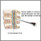 Lumbar puncture Lumbar puncture
