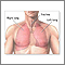Normal lung anatomy Normal lung anatomy