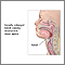 Obstructive sleep apnea Obstructive sleep apnea