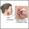 Oropharyngeal biopsy Oropharyngeal biopsy