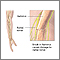 Radial nerve dysfunction Radial nerve dysfunction