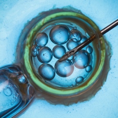 Assisted Reproductive Technology
