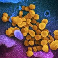 COVID-19 (Coronavirus Disease 2019)