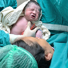 Cesarean Section
