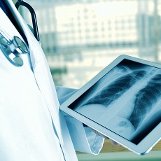 Chest Injuries and Disorders