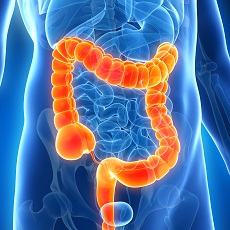 Colonic Diseases