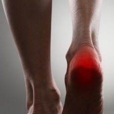 Heel Injuries and Disorders