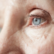 Macular Degeneration