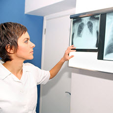 Pulmonary Hypertension