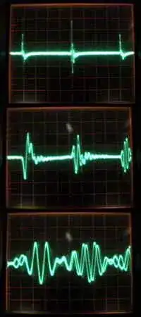 pulse noise on a scope