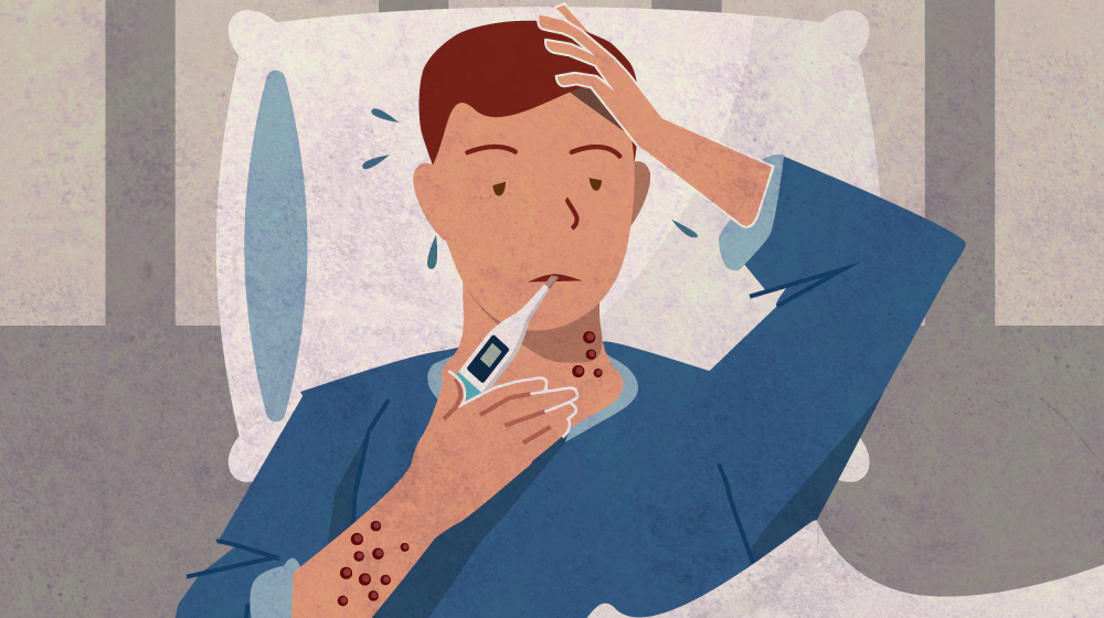 Mpox sick in bed Illustration of a man sick in bed with a thermometer in his mouth and rash on his arm